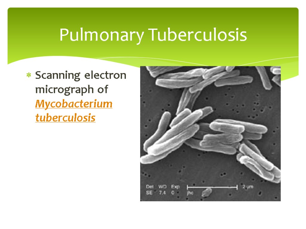 Pulmonary Tuberculosis Scanning electron micrograph of Mycobacterium tuberculosis